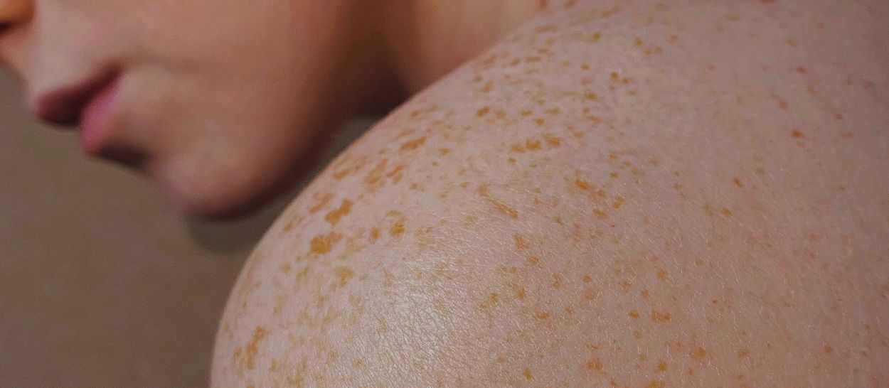 Colchões de látex natural e alergias: a verdade sobre os ácaros - Kipli